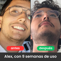 2 Bálsamos Adicionales Apolo Ultra Potente con Minoxidil 20%