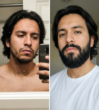 APOLO MINOXIDIL 20%