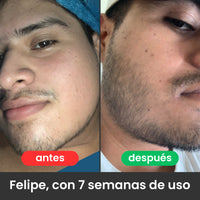 2 Bálsamos Adicionales Apolo Ultra Potente con Minoxidil 20%